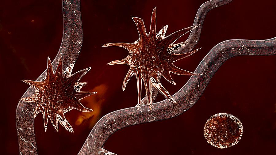 Ученые рассказали о способах уберечься от рака